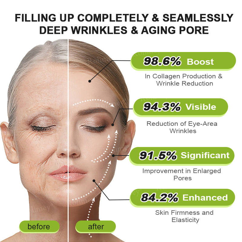 👨‍⚕️Clinically tested collagen repair system 🎁Botox & Vita-A Retinol Shot Wrinkle-Lift Tightening cream - Last Day Promotion 70% OFF