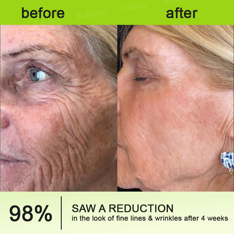 👨‍⚕️Clinically tested collagen repair system 🎁Botox & Vita-A Retinol Shot Wrinkle-Lift Tightening cream - Last Day Promotion 70% OFF