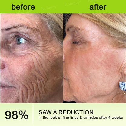 👨‍⚕️Clinically tested collagen repair system 🎁Botox & Vita-A Retinol Shot Wrinkle-Lift Tightening cream - Last Day Promotion 70% OFF