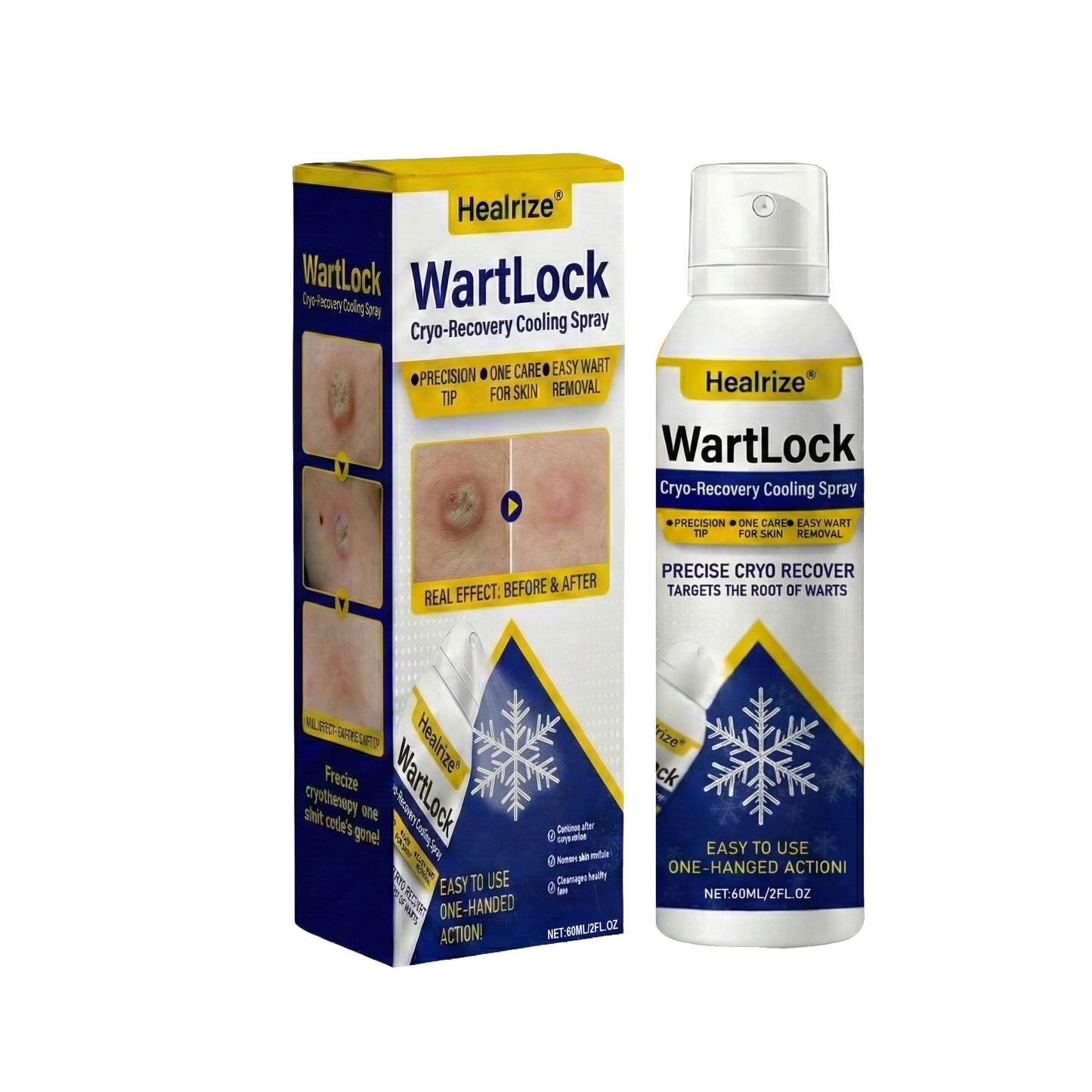 🏆Flash Sale⚡ 50K+ SOLD⏰✨|  Healrize® Wart Lock Cryo-Recovery Cooling Spray