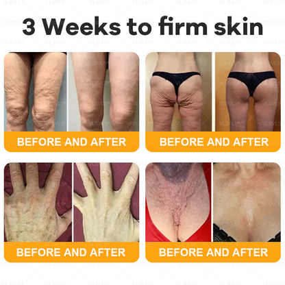 VLSVLS® Bee Venom Comprehensive Cream  👑👑👑LAST DAY 80% OFF (Sagging Skin, Fine Lines, Loss of Firmness, Flat Bust, Drooping Hips, and More💎)