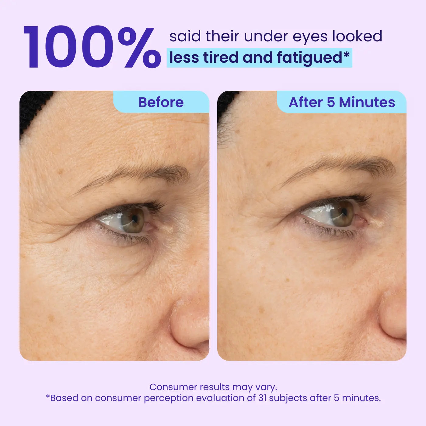 🎁Mother's Day Special 60% OFF🔥 Instant Lift Eye Gel for Puffiness, Bags & Dark Circles(𝑽𝒊𝒔𝒊𝒃𝒍𝒆 𝑹𝒆𝒔𝒖𝒍𝒕𝒔 𝒊𝒏 𝑱𝒖𝒔𝒕 5 𝑴𝒊𝒏𝒖𝒕𝒆𝒔)