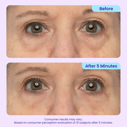 🎁Mother's Day Special 60% OFF🔥 Instant Lift Eye Gel for Puffiness, Bags & Dark Circles(𝑽𝒊𝒔𝒊𝒃𝒍𝒆 𝑹𝒆𝒔𝒖𝒍𝒕𝒔 𝒊𝒏 𝑱𝒖𝒔𝒕 5 𝑴𝒊𝒏𝒖𝒕𝒆𝒔)