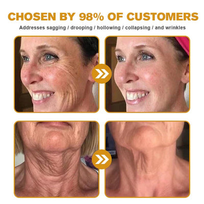 👨‍⚕️Clinically tested collagen repair system🎁 Bee Venom Wrinkle Removal Cream