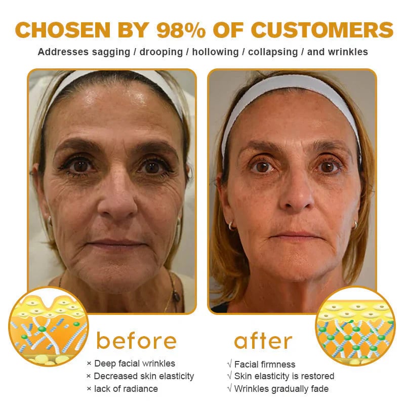 👨‍⚕️Clinically tested collagen repair system🎁 Bee Venom Wrinkle Removal Cream