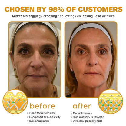 👨‍⚕️Clinically tested collagen repair system🎁 Bee Venom Wrinkle Removal Cream