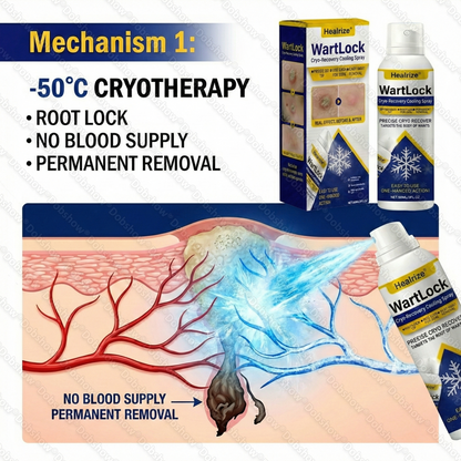 🏆Flash Sale⚡ 50K+ SOLD⏰✨|  Healrize® Wart Lock Cryo-Recovery Cooling Spray