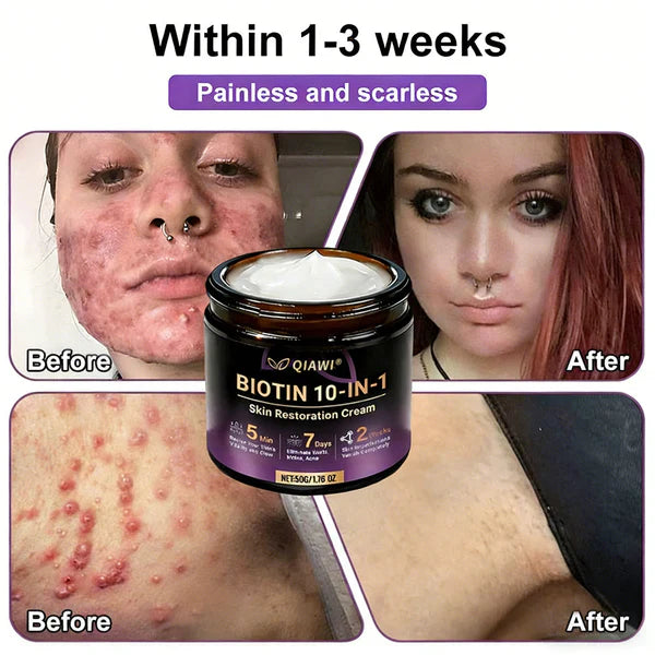 Made and Shipped from USA ✨QIAWI® Biotin 10-in-1 Skin Restoration Cream 🍀